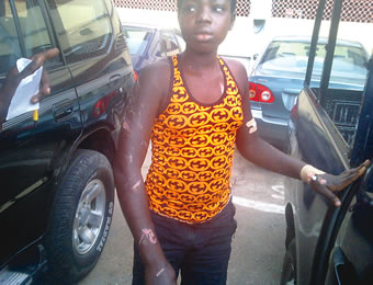 The assaulted girl, Kemi Leona, at the police station, in Lagos, on Monday.