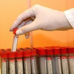 HIV in Nigerian children, inadequate data hampers HIV control, HIV, AIDS, NACA, screening