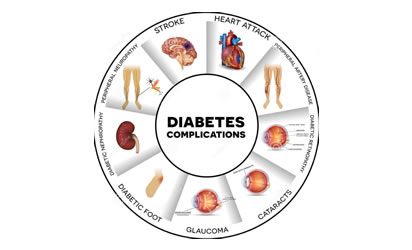 Diabetes, 6.7million deaths globally linked to diabetes in 2021, Report
