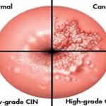 ‘Evidence still lacking that vitamins prevent CVD, cancer’