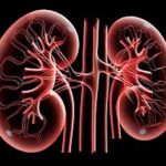 Check that your kidneys are okay, disease, end-stage kidney disease