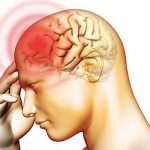 cerebrospinal-meningitis