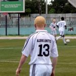 albino-footballer