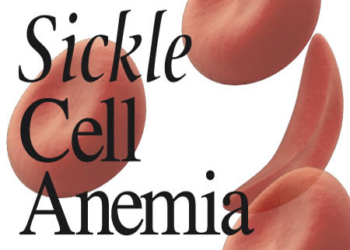 prevent sickle cell disease crises, Sickle cell survivor, sickle cell, African Sickle Cell Congress