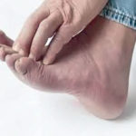 My thick discolored toenails