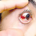 eye