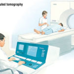 Computed Tomography CT