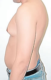 breasts