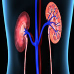 kidney disease?