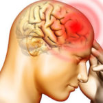 headache