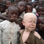 supports for Albinos