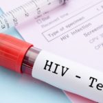 Know your status Why HIV testing HIV status