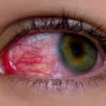 eye