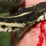 Over 700 snakebite victims treated, Snake bite, snakebites, snakebite
