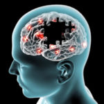 Alzheimer’s disease among Africans
