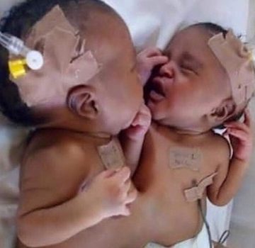 Twins