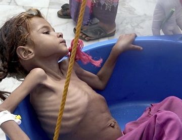 Yemen