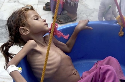 Yemen