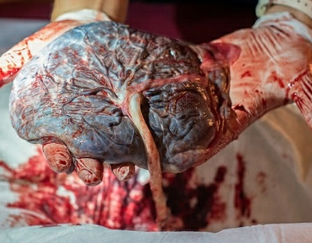 Placenta