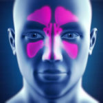 sinus infection