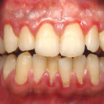 teeth