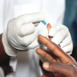 HIV