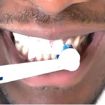 whitening tooth