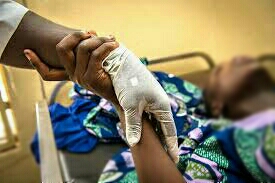 Abortion