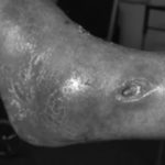 ankle, village, uncle, leg sore