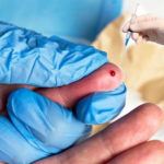 Needlestick, sharp injuries,UCH, hepatitis b