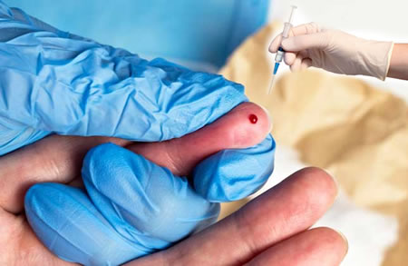 Needlestick, sharp injuries,UCH, hepatitis b
