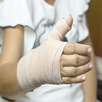 Fracture