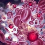 NCS receives N50 million , children diagnosed with cancer, New cases of cancer, cancer-causing virus , cancer registration, Nigeria, danger of cancer, Cancer Survivors Day