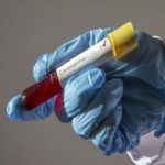 Kogi records first case , FMC Abeokuta staff covid-19, Politics of COVID-19, positive for coronavirus, COVID-19, Doctor, osun