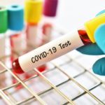 positive case, Ondo, coronavirus , COVID-19