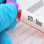 STIs