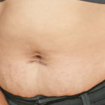 TUMMY