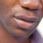 lower lip
