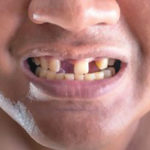 TEETH