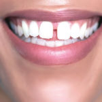 teeth