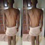 Delta indigene with heart condition