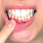 GUMS