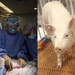 transplant pig's kidney into human
