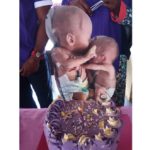 celebrate World Premature Day