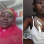 N15m for kidney transplant
