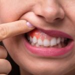 gum