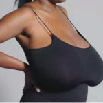 Breast sagging