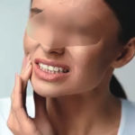 My teeth problem