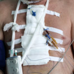 White bandage on human chest