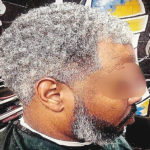 Is grey hair reversible hairs
